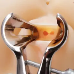 Biki Kalça Masturbator – Titreşimli & 2 İşlevli | 724Haz